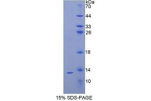 SDS-PAGE (SDS) image for Parathyroid Hormone (PTH) (AA 31-115) protein (His tag) (ABIN1080448)