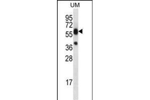 LI Antibody (C-term) (ABIN656461 and ABIN2845745) western blot analysis in uterus tumor cell line lysates (35 μg/lane).