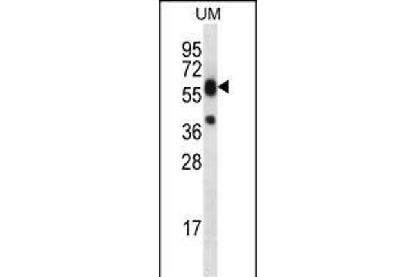 LIPM Antikörper  (C-Term)