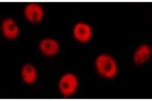 ABIN6277733 staining  Hela cells by IF/ICC. (RAD21 anticorps  (C-Term))