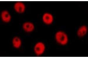 ABIN6277733 staining  Hela cells by IF/ICC. (RAD21 anticorps  (C-Term))