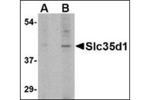Western blot analysis of Slc35D1 in Daudi lysate with this product at (A) 1 and (B) 2 μg/ml.