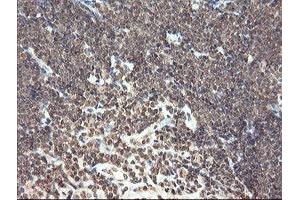 Image no. 10 for anti-Pyridoxamine 5'-Phosphate Oxidase (PNPO) antibody (ABIN1500318)