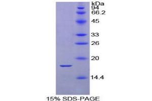 SDS-PAGE (SDS) image for Calmodulin 1 (Calm1) (AA 1-149) protein (His tag) (ABIN1079029) (Calmodulin 1 Protein (Calm1) (AA 1-149) (His tag))