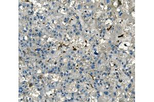 IHC analysis of AKR1D1 using anti-AKR1D1 antibody (ABIN7602741). (AKR1D1 anticorps  (C-Term))