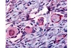 Immunohistochemistry (IHC) image for anti-Nuclear Receptor Subfamily 4, Group A, Member 1 (NR4A1) (Internal Region) antibody (ABIN2469316)