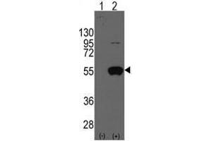 Image no. 1 for anti-Aldehyde Dehydrogenase 2 Family (Mitochondrial) (ALDH2) (N-Term) antibody (ABIN356917) (ALDH2 anticorps  (N-Term))