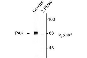 Image no. 1 for anti-P21-Activated Kinase 1 (PAK1) (pThr402) antibody (ABIN372696) (PAK1 anticorps  (pThr402))