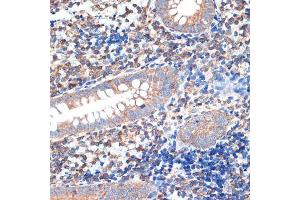 Immunohistochemistry of paraffin-embedded human appendix using CRMP5/DPYSL5 Rabbit mAb (ABIN7266774) at dilution of 1:100 (40x lens). (DPYSL5 anticorps)