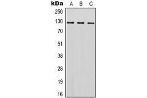 Western blot analysis of SREBP1 expression in Hela (A), Jurkat (B), NIH3T3 (C) whole cell lysates. (SREBF1 anticorps)
