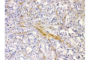 IHC analysis of CHRNA5 using anti-CHRNA5 antibody .