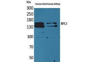 Western Blotting (WB) image for anti-Replication Factor C (Activator 1) 1, 145kDa (RFC1) (Internal Region) antibody (ABIN3178344) (RFC1 anticorps  (Internal Region))
