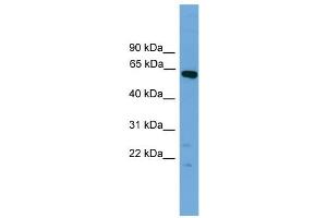 WB Suggested Anti-Tbx22 Antibody Titration:  0. (T-Box 22 anticorps  (N-Term))