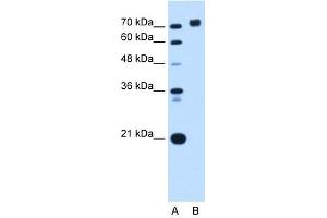 PTPRN antibody used at 0. (PTPRN anticorps  (Middle Region))