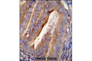 OGN Antibody immunohistochemistry analysis in formalin fixed and paraffin embedded human uterus tissue followed by peroxidase conjugation of the secondary antibody and DAB staining. (OGN anticorps  (C-Term))