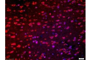 Tissue: rat brain tissue; 4% Paraformaldehyde-fixed and paraffin-embedded; Antigen retrieval: citrate buffer (0. (Robo1/ 2 (AA 51-150) anticorps)