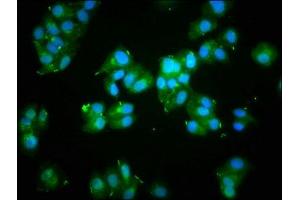 Immunofluorescence staining of HepG2 cells with ABIN7139708 at 1:133, counter-stained with DAPI.