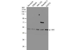 WB Image Various whole cell extracts (30 μg) were separated by 10% SDS-PAGE, and the membrane was blotted with ILK antibody [N1C1] , diluted at 1:500. (ILK anticorps)