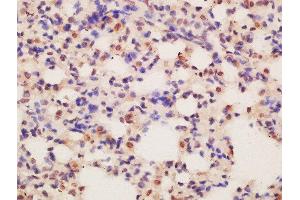 Formalin-fixed and paraffin embedded mouse lung labeled with Rabbit Anti-ASCL2 Polyclonal Antibody, Unconjugated  at 1:200 followed by conjugation to the secondary antibody and DAB staining (ASCL2 anticorps)