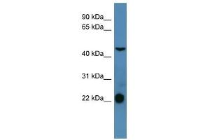 SSTR1 antibody used at 0. (SSTR1 anticorps  (C-Term))