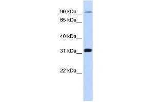 Cyclin M4 antibody used at 1 ug/ml to detect target protein. (CNNM4 anticorps  (Middle Region))
