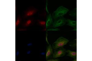 ABIN6263711 and ABIN6276848 staining  cells by IF/ICC.