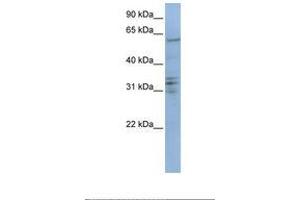 Image no. 1 for anti-Centromere Protein B (CENPB) (AA 506-555) antibody (ABIN6738799) (CENPB anticorps  (AA 506-555))