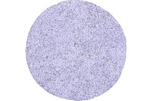 anti-T Cell Immunoreceptor with Ig and ITIM Domains (TIGIT) antibody