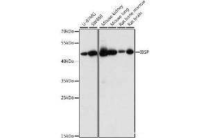 Western blot analysis of extracts of various cell lines using IBSP Polyclonal Antibody at dilution of 1:1000. (IBSP anticorps)