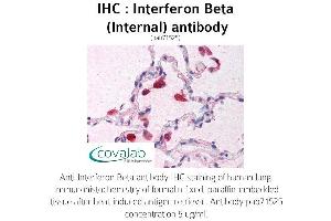 Image no. 1 for anti-Interferon, beta 1, Fibroblast (IFNB1) (Internal Region) antibody (ABIN1735973) (IFNB1 anticorps  (Internal Region))