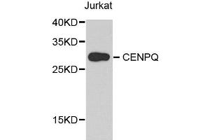 Western blot analysis of extract of various cells, using CENPQ antibody. (CENPQ anticorps)