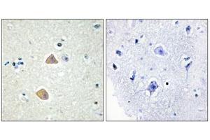 Immunohistochemistry analysis of paraffin-embedded human brain tissue using EFNA5 antibody. (Ephrin A5 anticorps  (Internal Region))