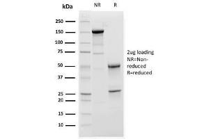 SDS-PAGE Analysis Purified C1QA Mouse Monoclonal Antibody (C1QA/2952). (C1QA anticorps  (AA 104-237))