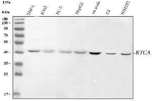 Western blot analysis of RTCA using anti-RTCA antibody (ABIN7599237).