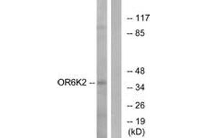 Western Blotting (WB) image for anti-Olfactory Receptor, Family 6, Subfamily K, Member 2 (OR6K2) (AA 271-320) antibody (ABIN2891042) (OR6K2 anticorps  (AA 271-320))