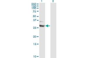 Western Blot analysis of CIDEA expression in transfected 293T cell line by CIDEA monoclonal antibody (M01), clone 4B9. (CIDEA anticorps  (AA 1-253))