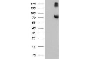 Western Blotting (WB) image for anti-F-Box Protein 21 (FBXO21) antibody (ABIN1498238) (FBXO21 anticorps)