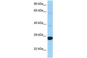 Image no. 1 for anti-Dehydrogenase/reductase (SDR Family) Member 4 Like 2 (DHRS4L2) (C-Term) antibody (ABIN6748237) (DHRS4L2 anticorps  (C-Term))