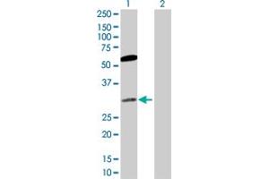 Western Blot analysis of CACYBP expression in transfected 293T cell line by CACYBP MaxPab polyclonal antibody. (CACYBP anticorps  (AA 1-228))