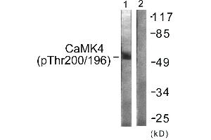 Immunohistochemistry analysis of paraffin-embedded human brain tissue using CaMK4 (Phospho-Thr196/200) antibody. (CAMK4 anticorps  (pThr196, pThr200))