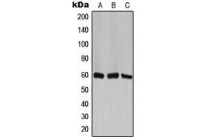 Western blot analysis of TCP1 zeta expression in H1299 (A), mouse brain (B), PC12 (C) whole cell lysates. (CCT6A anticorps  (Center))
