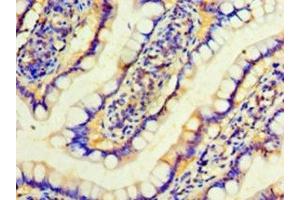 Immunohistochemistry of paraffin-embedded human small intestine tissue using ABIN7156569 at dilution of 1:100 (IFNA4 anticorps  (AA 24-189))