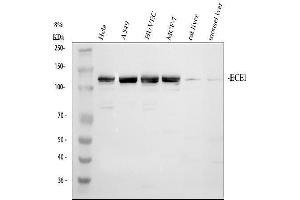 Western blot analysis of ECE1 using anti-ECE1 antibody (ABIN5518828).