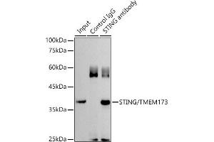 Immunoprecipitation analysis of 300 μg extracts of HT-29 cells using 3 μg STING/TMEM173 antibody (ABIN1683049, ABIN3017833, ABIN3017834 and ABIN6220283).