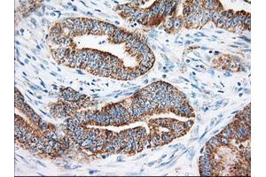 Immunohistochemical staining of paraffin-embedded Human liver tissue using anti-KHK mouse monoclonal antibody. (Ketohexokinase anticorps)