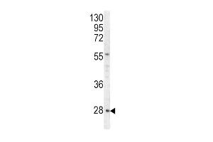 Western blot analysis of HPRT1 antibody (C-term) (ABIN390692 and ABIN2840982) in Hela cell line lysates (35 μg/lane). (HPRT1 anticorps  (C-Term))