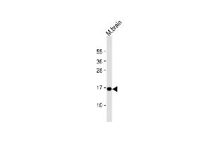 Anti-CPLX1 Antibody (Center) at 1:1000 dilution + mouse brain lysate Lysates/proteins at 20 μg per lane.