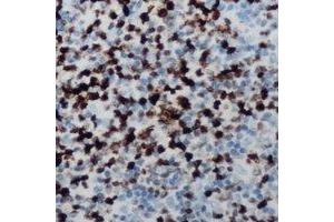 Immunohistochemical analysis of CCNB1IP1 staining in human lymph node formalin fixed paraffin embedded tissue section. (CCNB1IP1 anticorps  (C-Term))