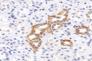 Immunohistochemistry analysis of paraffin-embedded rat kidney using,IVD (ABIN7074382) at dilution of 1: 2800 (IVD anticorps)
