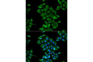 Immunofluorescence analysis of HeLa cells using CTNS antibody. (CTNS anticorps)